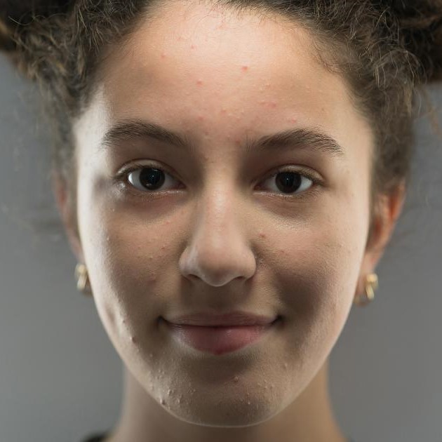 Un filtre Instagram n’a jamais fait de mal à personne, vraiment ? Avec filtre Un filtre Instagram n’a jamais fait de mal à personne, vraiment ? Avec filtre